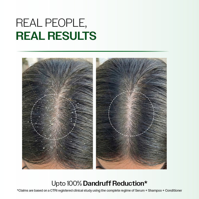 Advanced Anti-Dandruff Serum  With Defenscalp™, Salicylic Acid & Pentavitin - 50 ml | Pack of 3
