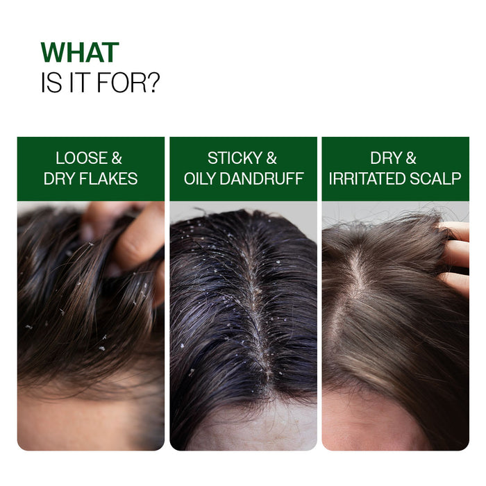 Advanced Anti-Dandruff Serum  With Defenscalp™, Salicylic Acid & Pentavitin - 50 ml | Pack of 3