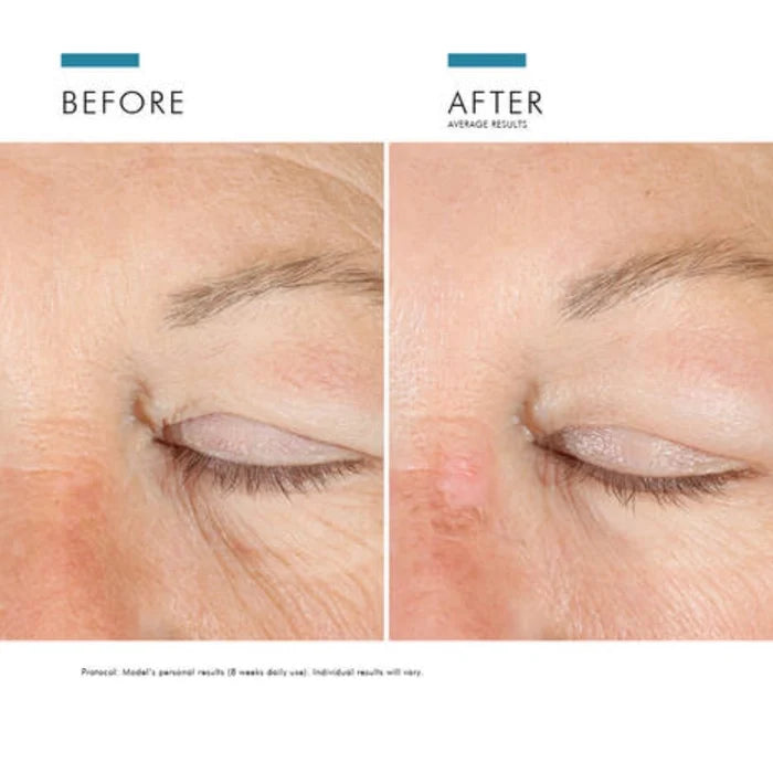 A.G.E. Eye Complex