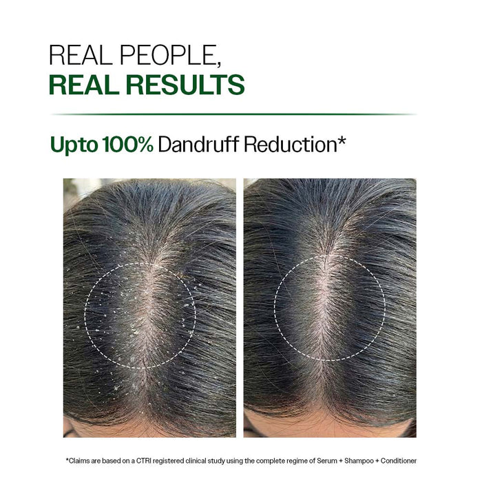 Anti Dandruff Shampoo with Salicylic Acid, Piroctone Olamine & Biotin - 100 ml | Pack of 3