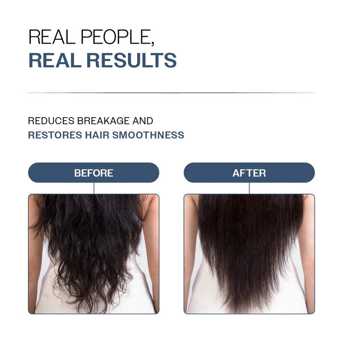 Anti-Hair Fall Conditioner With Redensyl, Rosemary & Peptides - 175 gm | Pack of 3