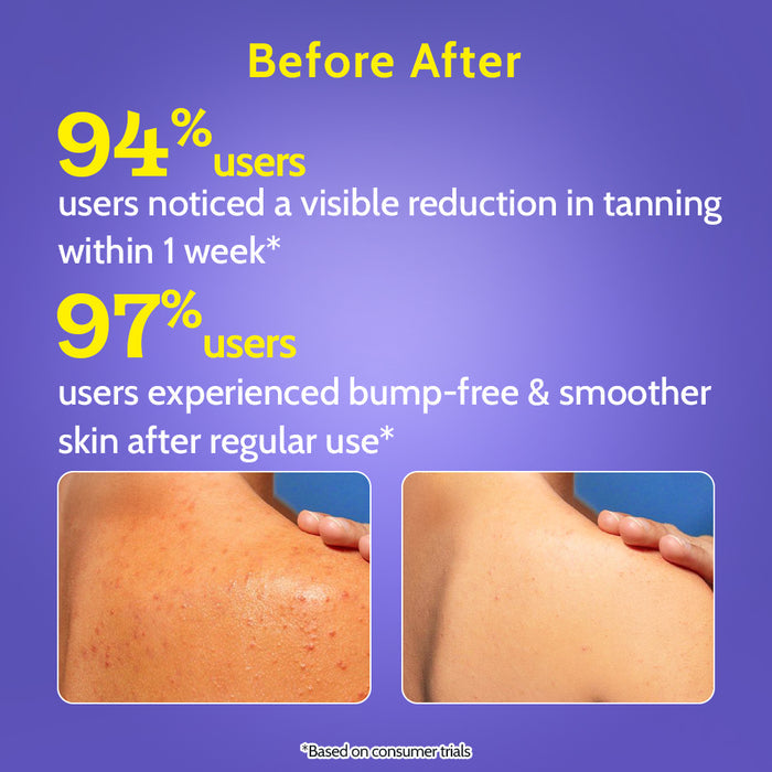 Exfoliating Body Wash with 1% Lactic Acid & 2% Salicylic Acid - 473 ml | Pack of 3