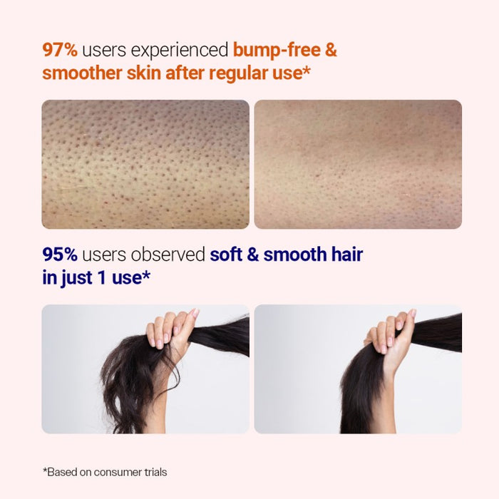 Hair & Skin Bestseller Duo | Rosemary Hair Growth Spray - 200 ml & Exfoliating Body Wash - 236 ml