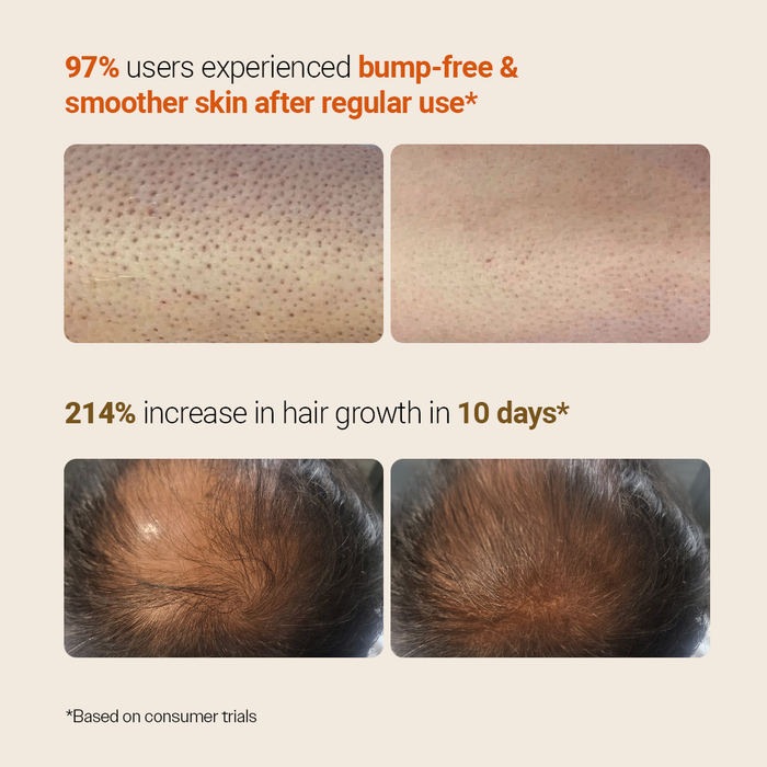 Healthy Hair & Skin Duo | Advanced Hair Growth Serum 30 ml & Exfoliating Body Wash 236 ml