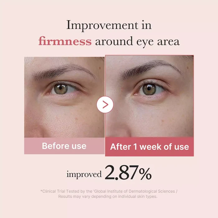 Medicube PDRN Pink Peptide Eye Cream - 30ml