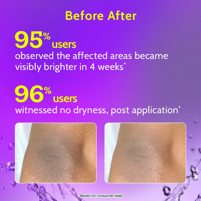 Neck, Knee & Elbow Brightening Roll On With Mandelic Acid & Niacinamide - 40 ml | Pack of 3