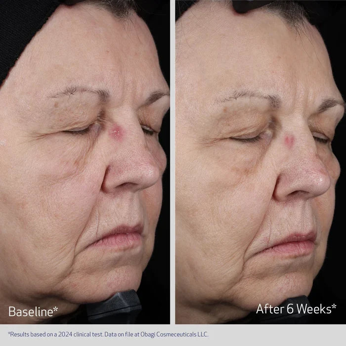 Obagi ELASTIderm Lift Up & Sculpt Facial Moisturizer