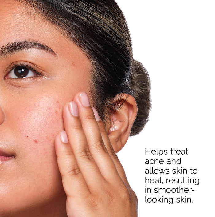 THE ORDINARY the acne set including salysilc acid 2% solution for the treatmint of acne مجموعة الساليسيلك اسد للعناية بالبشرة